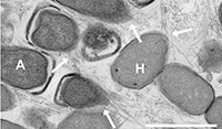 Mit Hilfe der Elektronenmikroskopie entdeckten die Wissenschaftler die Nano-Drähte, die bis zu mehrere Mikrometer lang wurden, einem Mehrfachen des Zelldurchmessers. Die Länge des weißen Balkens entspricht einem Mikrometer. Die Pfeile verweisen auf die Nano-Drähte. Foto: Max-Planck-Institut für Biophysikalische Chemie, Göttingen