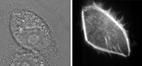 A glass pipette injects fluorescent molecules into a kidney cell (left photo). A few seconds later, the molecules light up revealing new details (right photo). Photo: Bielefeld University