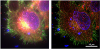 Bild: Menschliche Zelle unter konventionellem Mikroskop (links) und hochauflösendem Mikroskop (rechts). Bild: Dr. Wolfgang Hübner