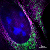 This image taken by the new microscope shows a living bone cancer cell with nucleus (blue), mitochondria (green) and cytoskeleton (magenta). Photo: Bielefeld University/W. Hübner
