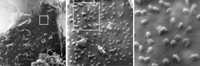 Bild: Eine mit SARS-CoV-2-infizierte Nierenzelle unter dem Heliumionen-Mikroskop (ausschnittsweise Vergrößerung von links nach rechts