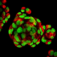 Stammzellen aus der Nasenmuschel: Die 630-fache Vergrößerung zeigt die Zellkerne (grün) und das Protein Nestin (rot), das typisch ist für Stammzellen.