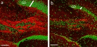 Die Nervenzellen (Zellkerne in grün) senden „Kabel“ (die Axone, in rot) aus, um sich untereinander zu verbinden. Diese Verbindung der Nervenzellen ist gewöhnlich gut ausgeprägt (Bild links). Bielefelder Forscher zeigten nun, dass erheblich weniger Verbindungen und Nervenzellen wachsen, wenn der Stoff NF-kB gehemmt wird (Bild rechts), so dass die Leistungsfähigkeit rapide abnimmt.