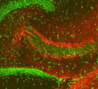 Mit Lichtmikroskopen lassen sich zum Beispiel Körperzellen sichtbar machen. Das Bild zeigt Nervenzellen des Gehirns und ihre Fortsätze (rot markiert) sowie die Erbsubstanz in den Zellkernen (grün markiert). Foto: Universität Bielefeld