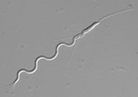 Spermien gibt es in den unterschiedlichsten Formen und Größen: Die Samenzelle des Platt-wurms „Macrostomum lignano“ (Bild) besitzt einen Vorderfühler (rechts) und zwei seitliche Borsten, mit denen er sich im weiblichen Geschlechtsorgan festsetzen kann. Foto: Universität Bielefeld