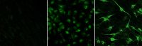 Adulte Stammzellen entwickeln sich in dopaminerge Nervenzellen. v.l. Beginn des Experiments, nach 12 Tagen und 20 Tagen der Entwicklung. Diese Stammzellen können dazu verwendet werden, das erkrankte Gehirn zu regenerieren. Foto: Universität Bielefeld