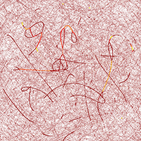 Special graphs represent connections between genomes as nodes. If individual genes of a single organism deviate significantly from the typical genes of its species, they are represented as conspicuous curves and lines. This is the case, for example, with genes that trigger hereditary diseases. Picture: Bielefeld University/R. Wittler