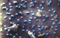 Coronaviren (blau) beim Austritt aus einer Nierenzelle, aufgenommen mit einem Heliumio-nen-Mikroskop. Foto: Universität Bielefeld/N. Frese