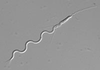 Bild: Spermien gibt es in den unterschiedlichsten Formen und Größen: Die Samenzelle des Platt-wurms „Macrostomum lignano“ (Bild) besitzt einen Vorderfühler (rechts) und zwei seitliche Borsten